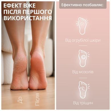 Пемза електрична для ніг акумуляторна роликова пилка для педикюру електро пемзи для п'ят видалення натоптишів мозолів ороговілої шкіри професійна шліфувальна машинка Swan Beauty біла