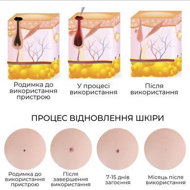 Електрокоагулятор Swan Beauty Smart Pen S60 для видалення папілом та бородавок апарат косметологічний білий