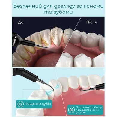 Скалер ультразвуковой для удаления зубного камня чистки зубов от налета домашний стоматологический портативный 3 режима с 2 насадками аккумуляторный беспроводной USB зарядка Type-C LED подсветка для отбеливания IPX6 профессиональный мощный Swan Beauty