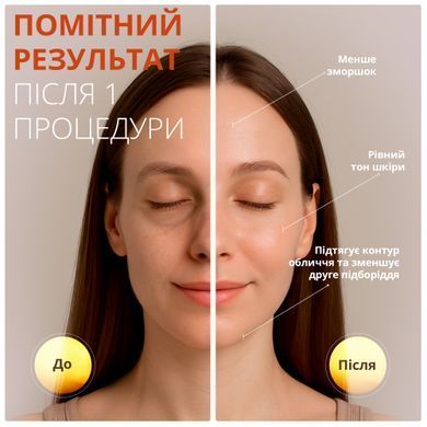 Мікрострумовий масажер для обличчя Swan Beauty Skin Boost RF30 з функцією LED світлотерапії та EMS RF мікроструми з ефектом ліфтингу шкіри білий