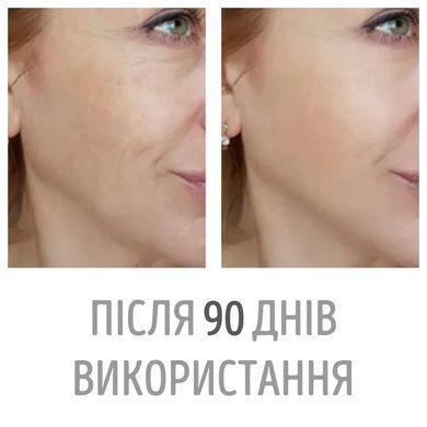 Мікрострумовий масажер для підборіддя Swan DS-FM0005 для підтяжки другого підборіддя 6 режимів 6 рівнів інтенсивності з пультом керування білий